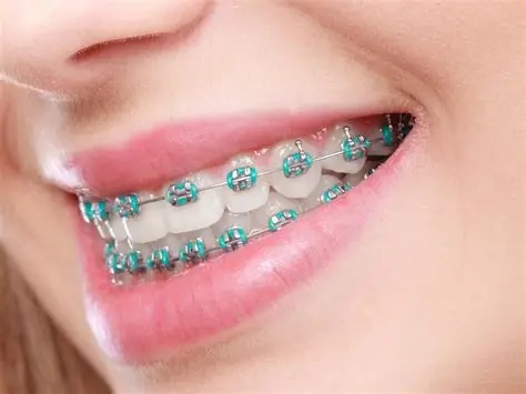 Orthodontic